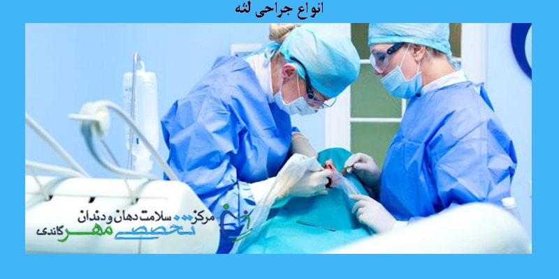 انواع جراحی لثه