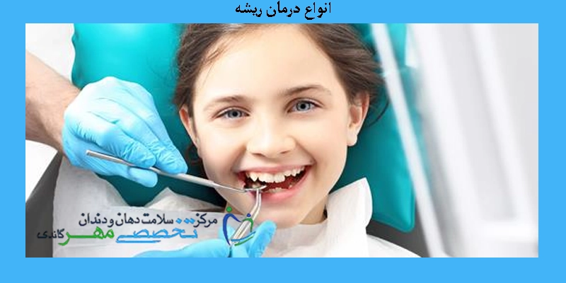 انواع درمان ریشه