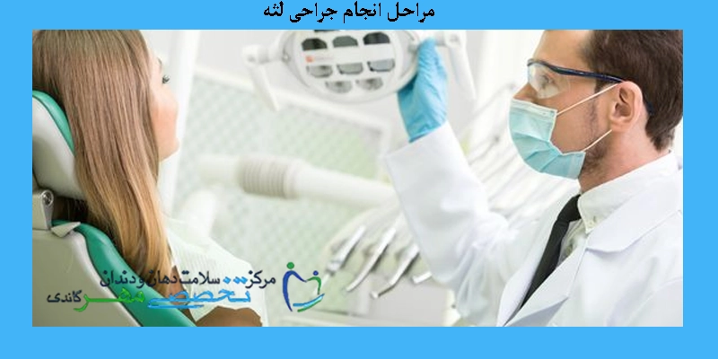 مراحل انجام جراحی لثه