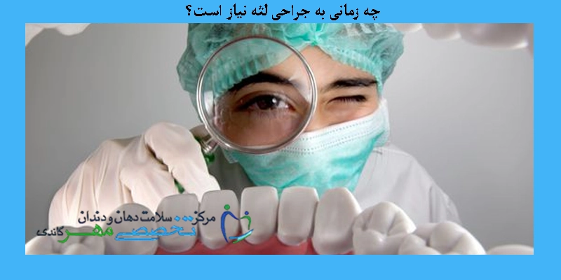 چه زمانی به جراحی لثه نیاز است؟