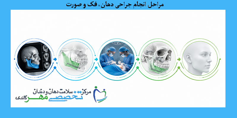 مراحل انجام جراحی دهان، فک و صورت