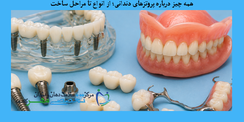 همه چیز درباره پروتزهای دندانی؛ از انواع تا مراحل ساخت