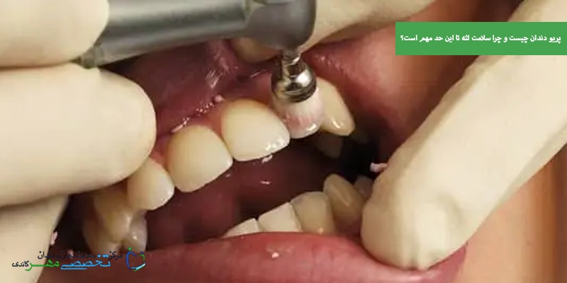 پریو دندان چیست و چرا سلامت لثه تا این حد مهم است؟