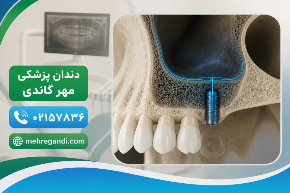 نمای توضیحی درباره شرایطی که نیاز به بررسی سهبعدی را بیشتر میکند