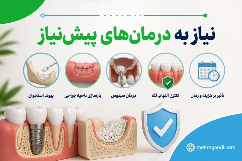 نیاز به درمان های پیشنیاز — هزینه ایمپلنت دندان