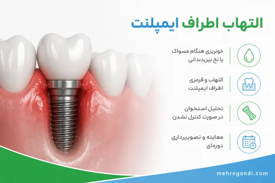نمای توضیحی درباره التهاب اطراف ایمپلنت