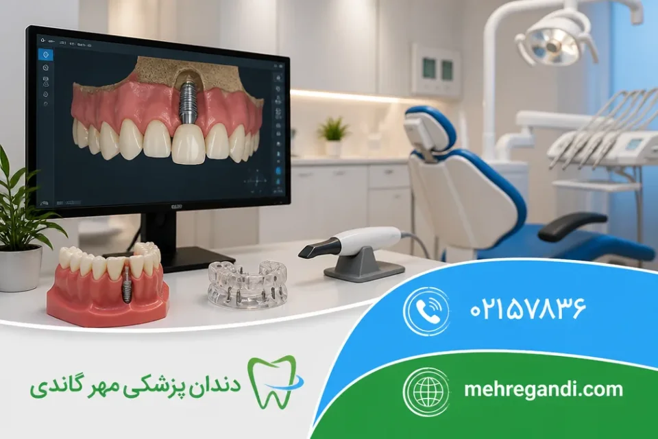 نمای توضیحی درباره تفاوت روکش موقت با روکش دائمی چیست