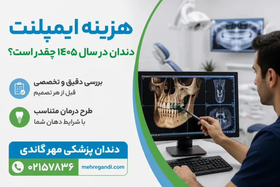 بررسی استخوان فک پیش از تعیین هزینه ایمپلنت